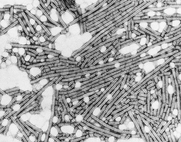tobacco mosaic virus transmission File:Tobacco mosaic virus symptoms tobacco.jpg