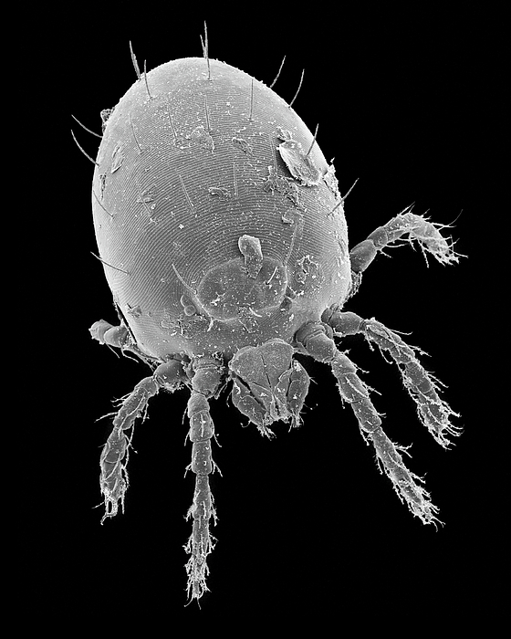 Chigger (metachirus Nudicaudatus) Greeting Card by Dennis Kunkel ...