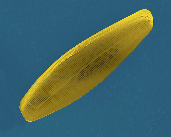 Pennate Diatom Frustule (navicula Sp.) Greeting Card by Dennis Kunkel ...