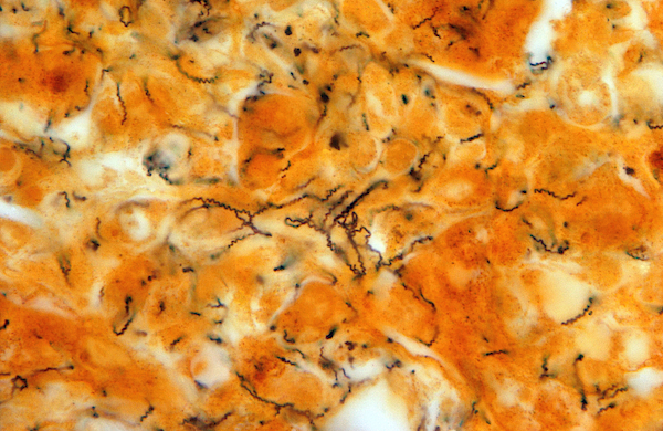 Syphilis Infection In Rabbit Testis Jigsaw Puzzle by Michael Abbey ...