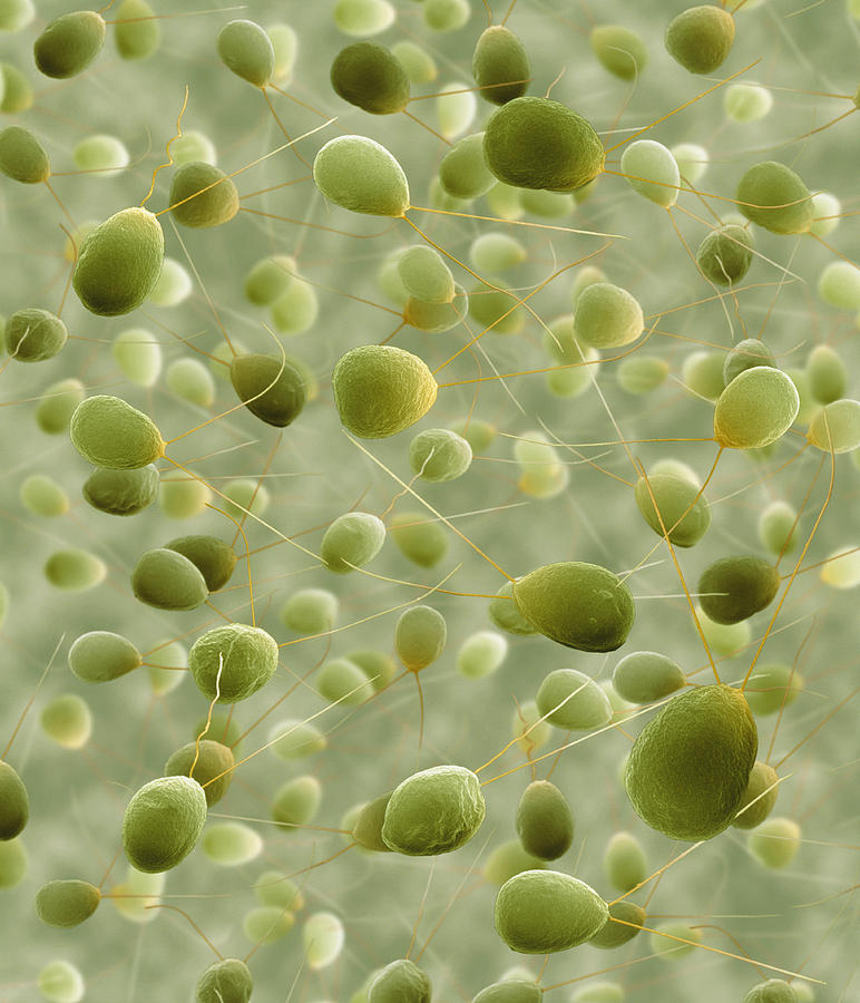 Susan Syred Chlamydomonas Sp. Algae, Sem #1 by Power And Syred / Science Photo Library