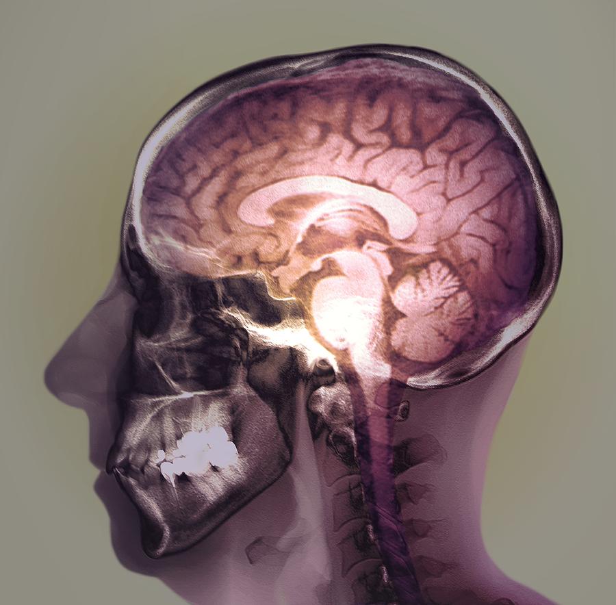 Visualized Brain Normal Normal Brain #1 by Zephyr / Science Photo Library