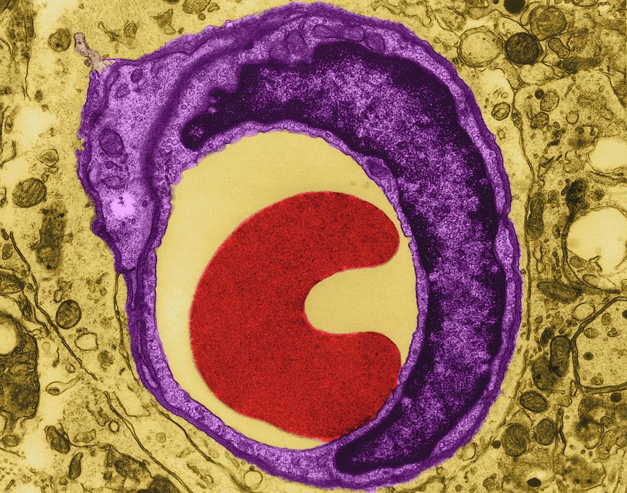 Red Blood Cell In A Capillary #1 by Dennis Kunkel Microscopy / Science ...