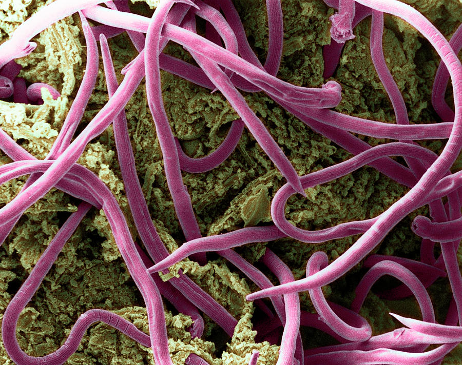 Threadworms In Intestine #1 by E. Gray / Science Photo Library