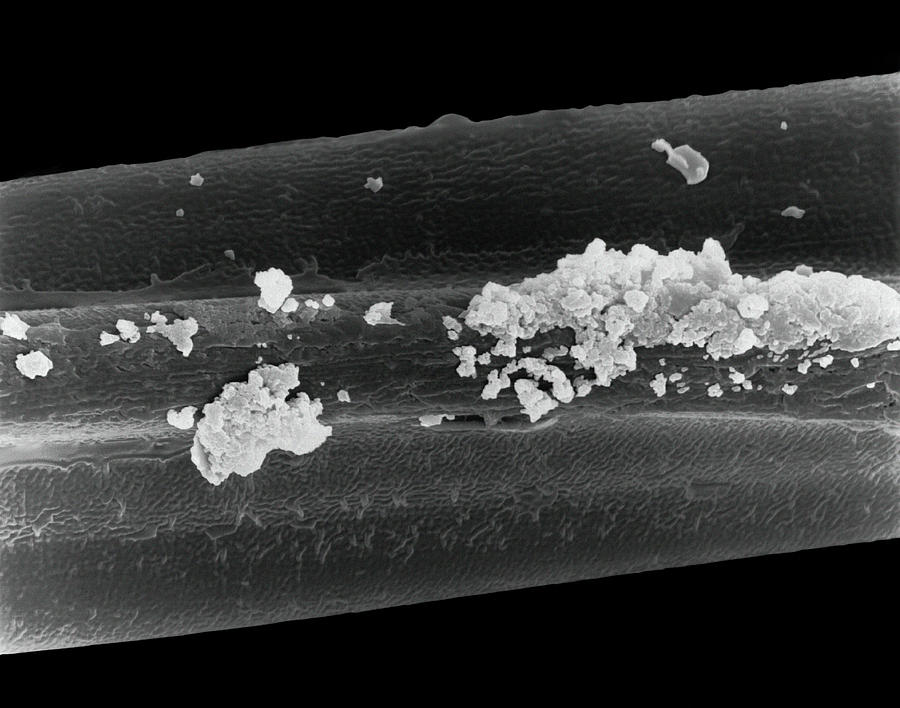 tobacco under a microscope Tobacco Smoke Particles On Filter Fibre #1 by Dennis Kunkel Microscopy /  Science Photo Library