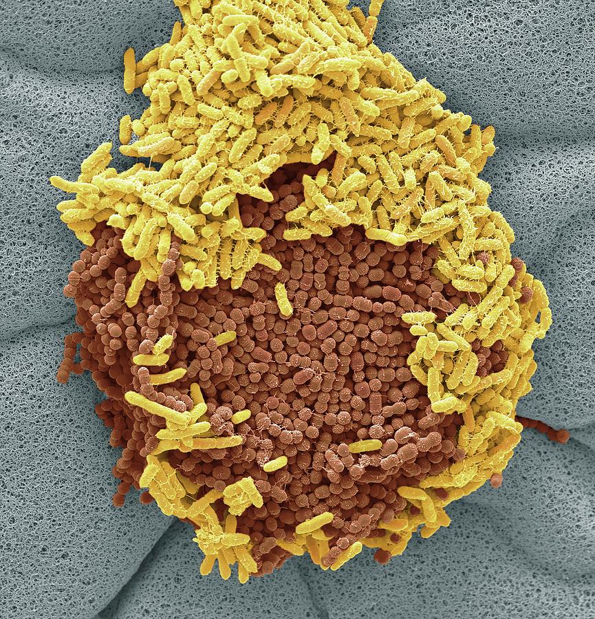 Faecal Bacteria #10 by Steve Gschmeissner / Science Photo Library
