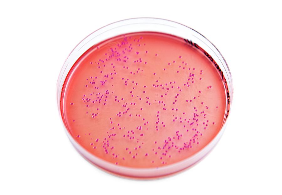 e coli liquid culture How to Grow Escherichia coli main image 0