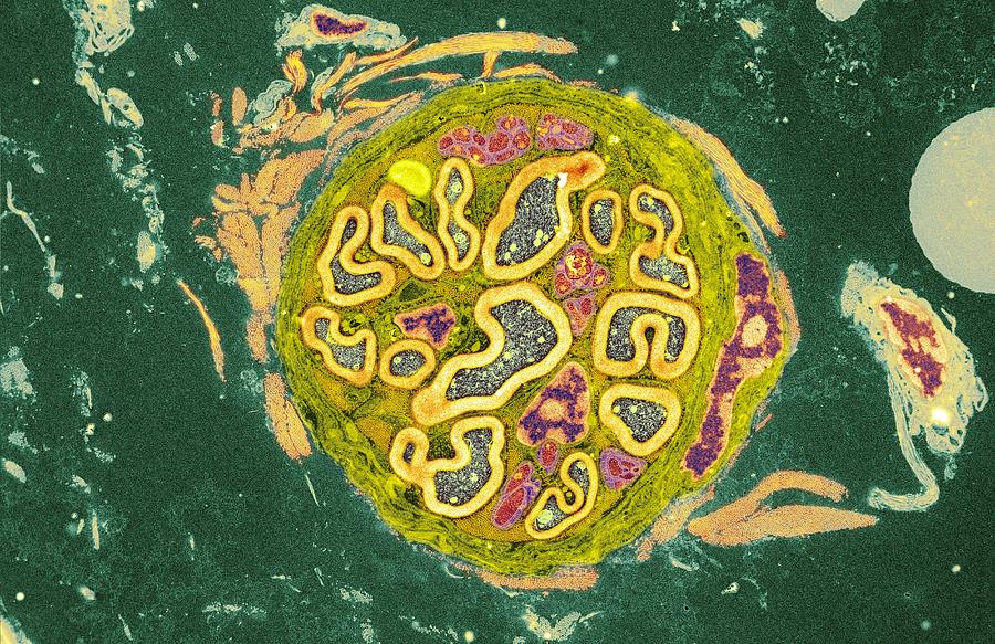 Myelinated nerve, TEM #2 by Steve Gschmeissner / Science Photo Library