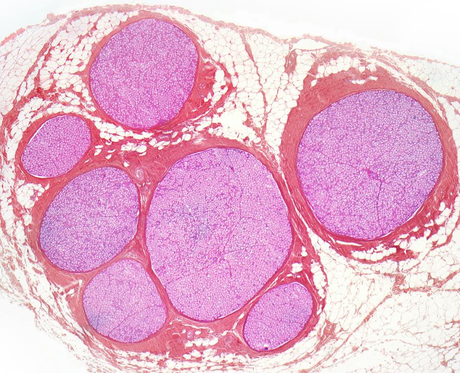 Nerve Fibres #2 by Steve Gschmeissner / Science Photo Library