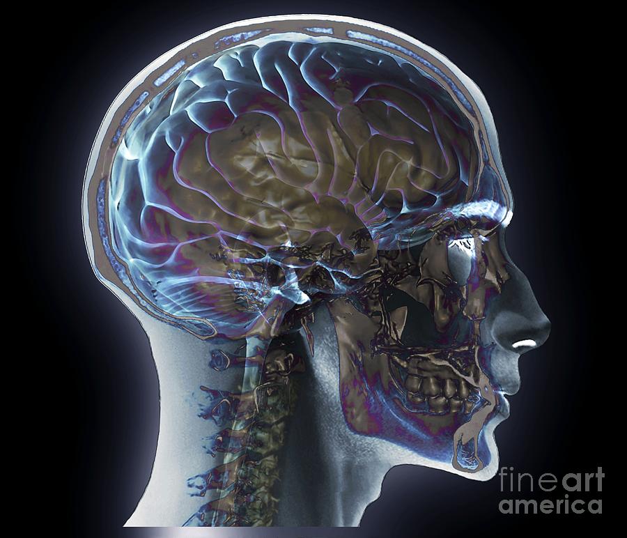 Normal Head And Neck, Mri And 3d Ct Scans #2 by Zephyr / Science Normal Head And Neck, Mri And 3d Ct Scans #2 by Zephyr / Science