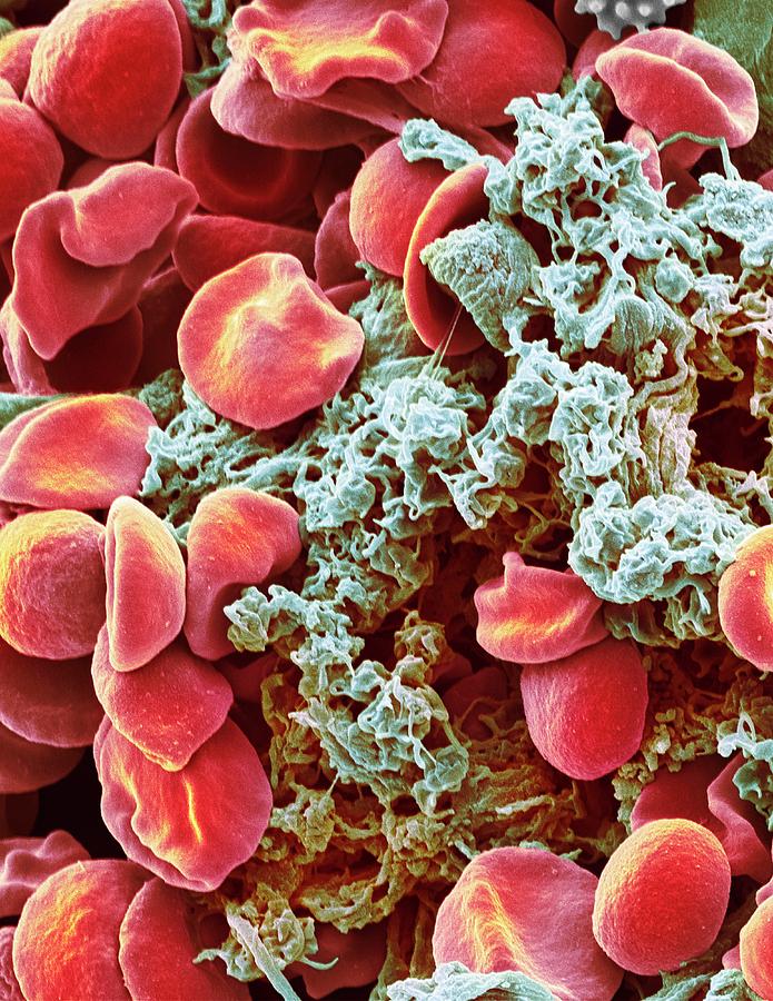Red Blood Cells And Platelets #2 by Steve Gschmeissner / Science Photo ...