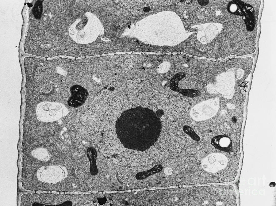 Root Cell Of Plant Tem #2 by David M. Phillips