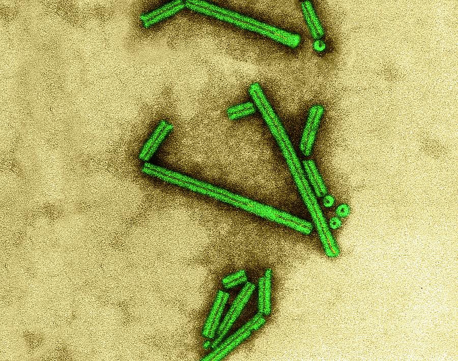 shape of tobacco mosaic virus Tobacco Mosaic Virus #2 by Dennis Kunkel Microscopy / Science Photo Library