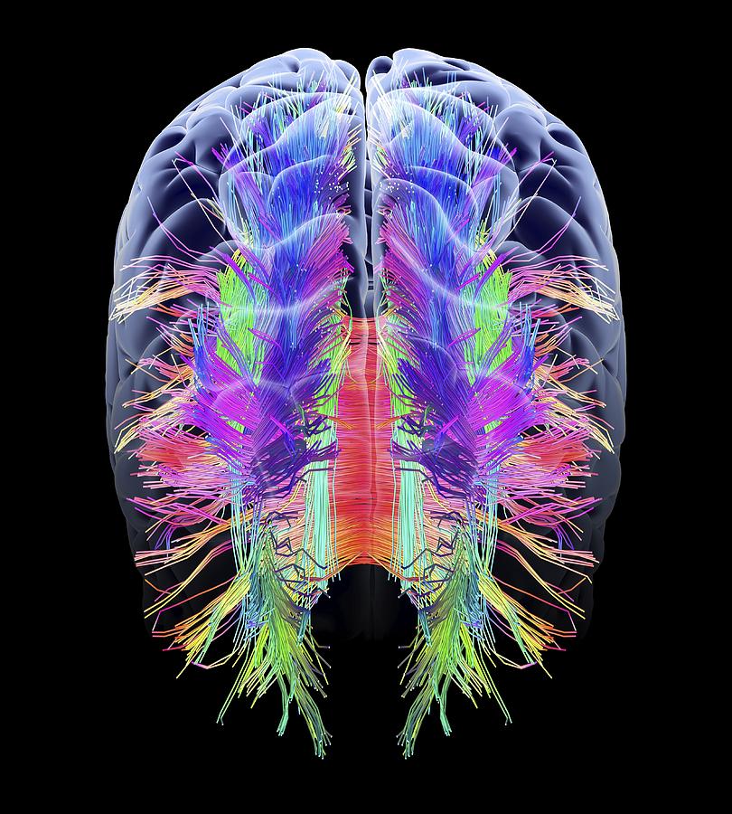 White matter fibres and brain, artwork #2 by Alfred Pasieka