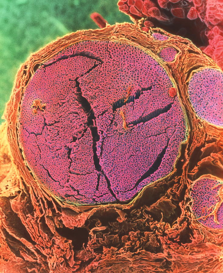 Nerve Fibres #3 by Steve Gschmeissner / Science Photo Library