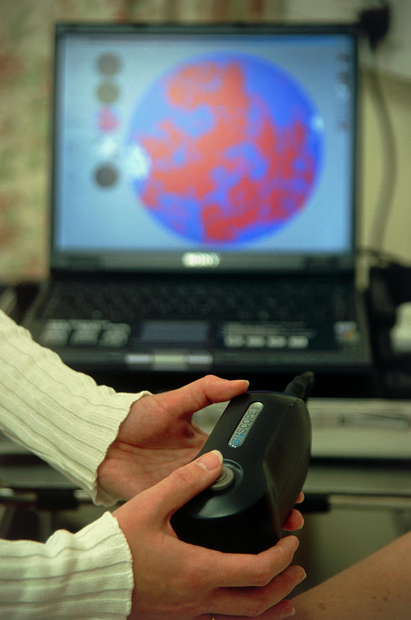 Skin Lesion Diagnosis #3 by Tracy Rutter / Science Photo Library