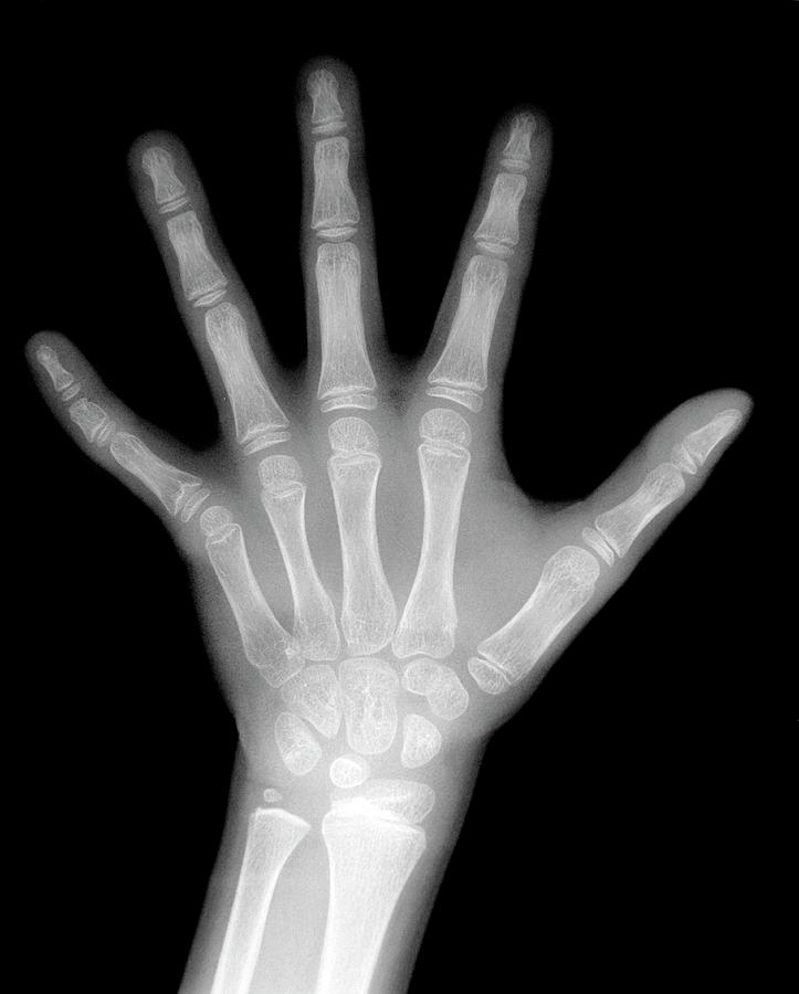 Child's Hand #4 by Aj Photo / Science Photo Library