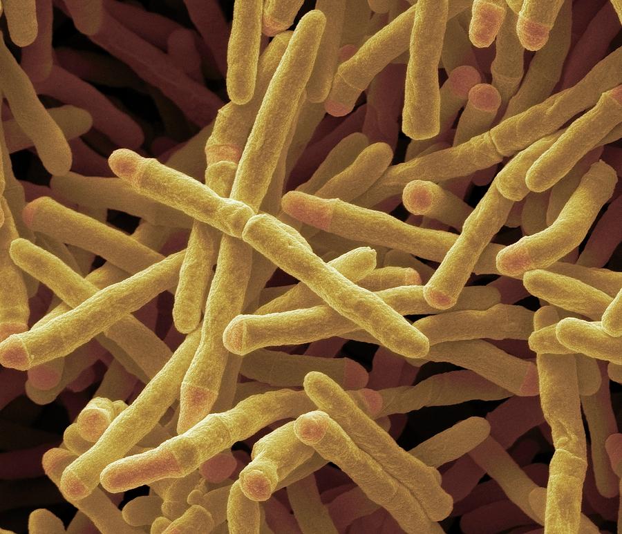 glutathione myscobacterium smegmatis Mycobacterium Bacteria by Steve Gschmeissner / Science Photo Library Frontiers | Dissecting the Mechanism