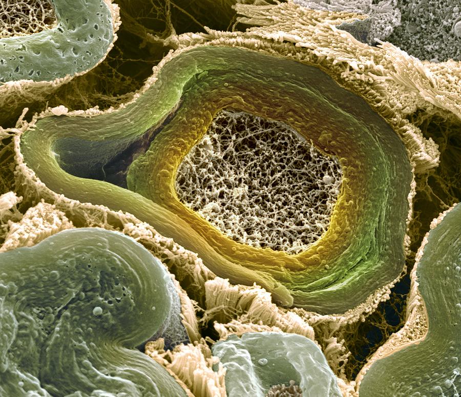 Myelinated nerves, SEM #4 by Steve Gschmeissner / Science Photo Library