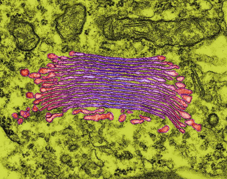 Plant (alga) Golgi Apparatus #4 by Dennis Kunkel Microscopy / Science Photo  Library