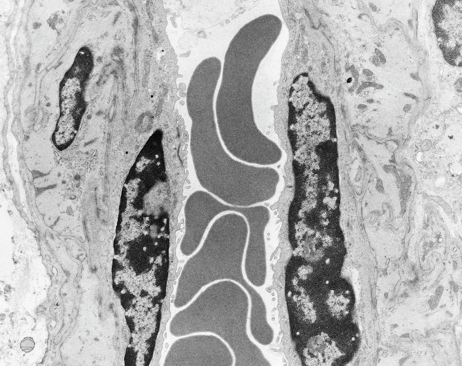Red Blood Cells In A Capillary #4 by Dennis Kunkel Microscopy / Science ...