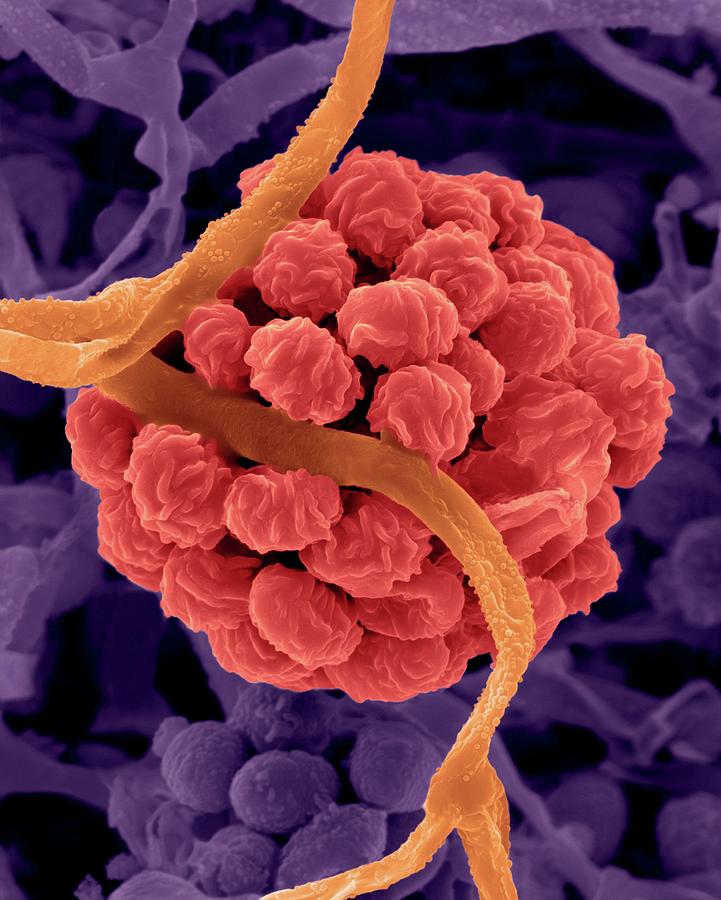 Stacky Botriss Stachybotrys Sp. Toxic Mould #4 by Dennis Kunkel Microscopy / Science ...