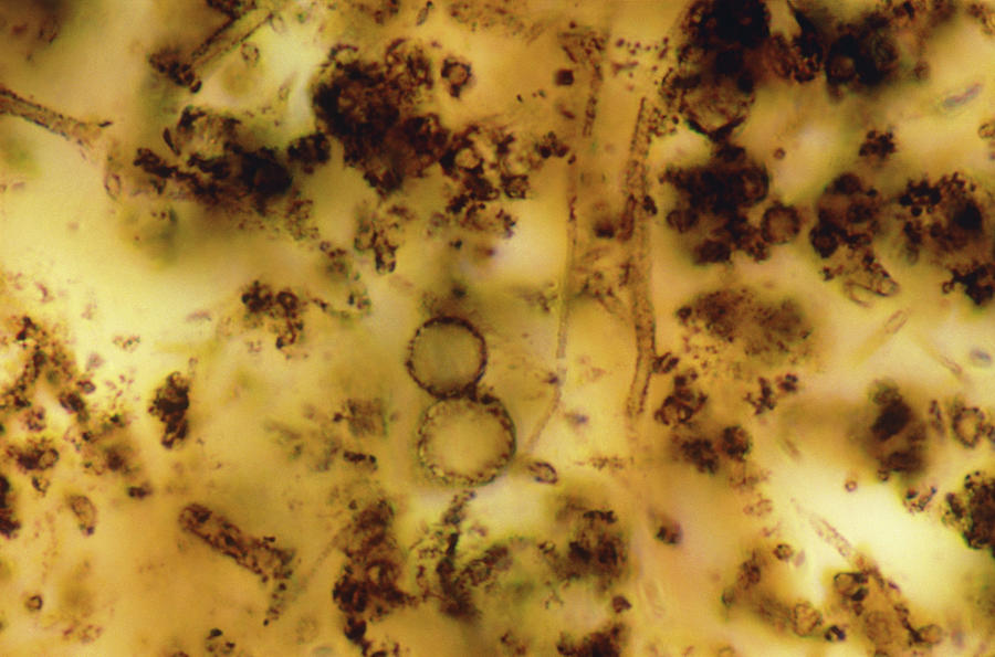 Primitive Plant Fossils #5 by Sinclair Stammers / Science Photo Library