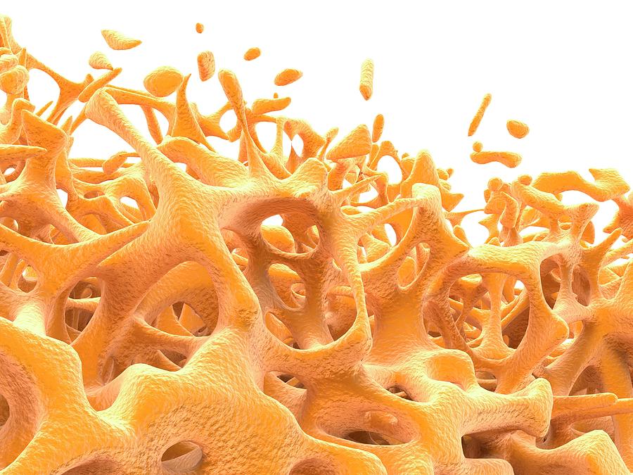 Botag Tissue Bone Tissue #8 by Alfred Pasieka / Science Photo Library