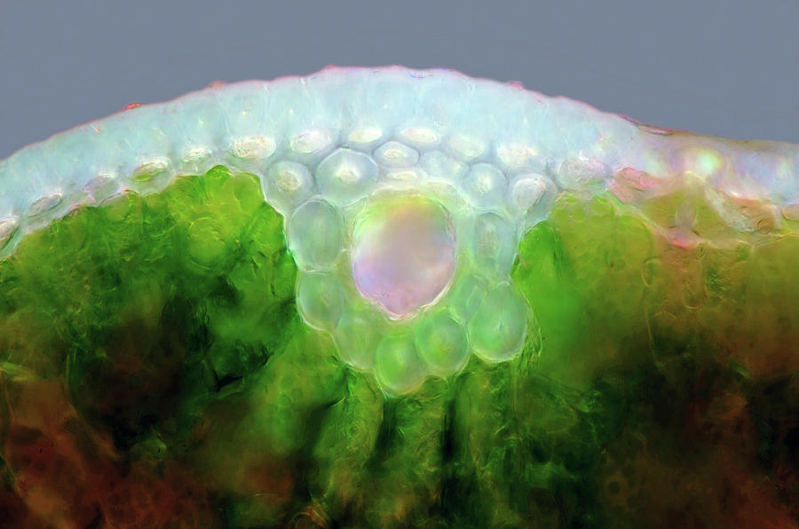 Pine Needle #8 by Marek Mis / Science Photo Library