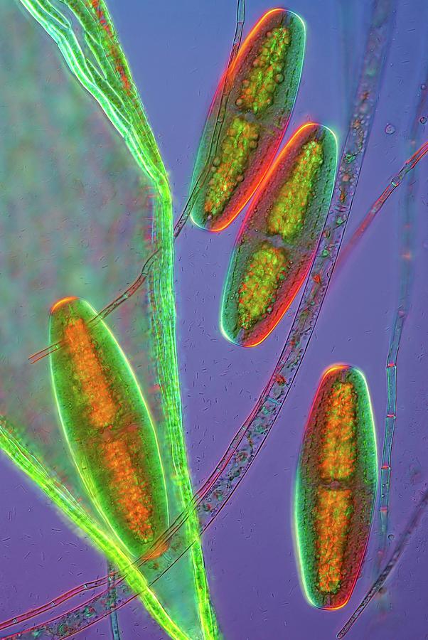 Netrium Sp Netrium Desmids #9 by Marek Mis / Science Photo Library