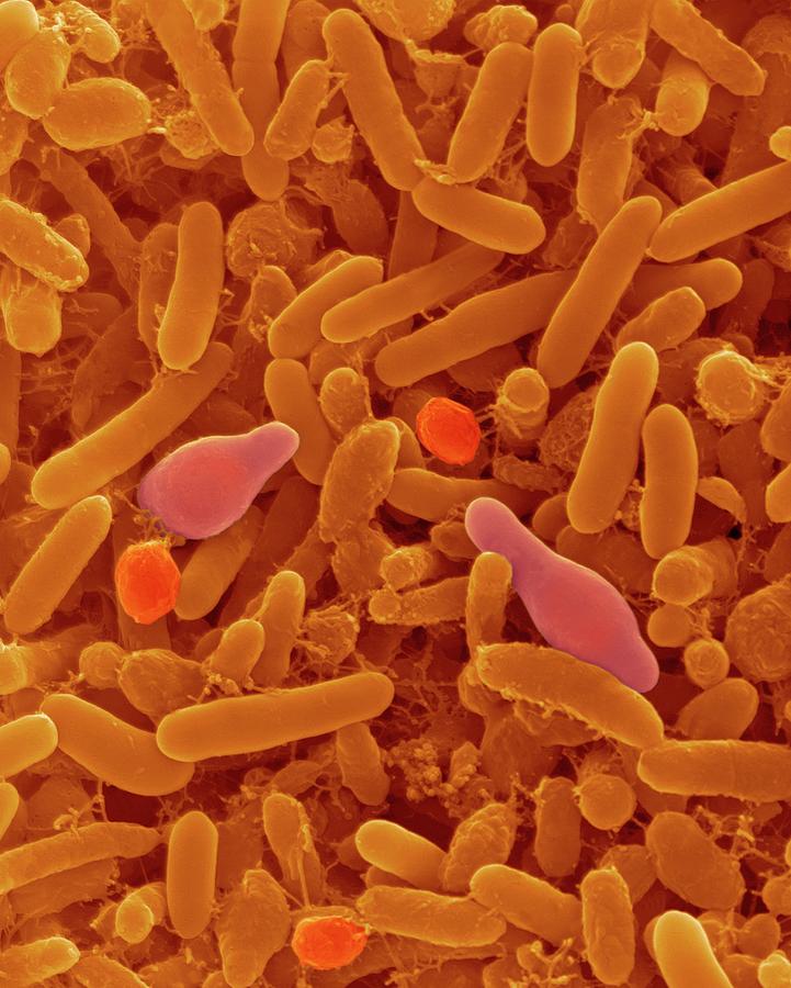 Alicyclobacillus Sp. Rod Prokaryote by Dennis Kunkel Microscopy ...