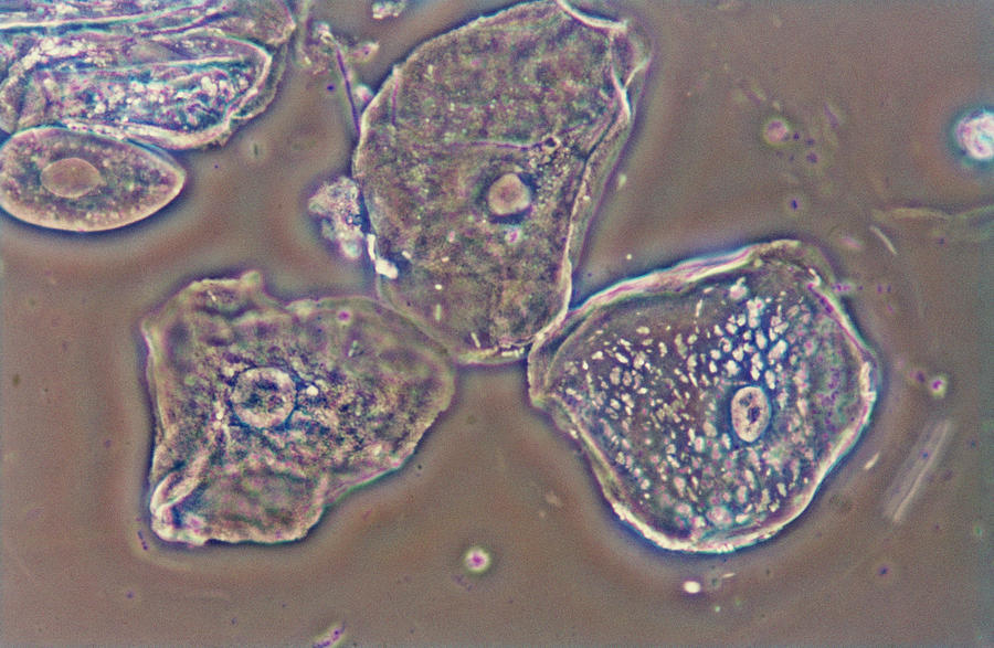 Cheek Cells by Biophoto Associates / Science Photo Library