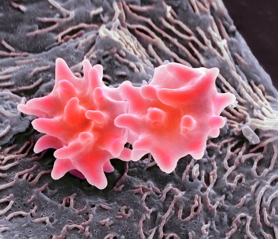 Crenated Red Blood Cells by Steve Gschmeissner / Science Photo Library