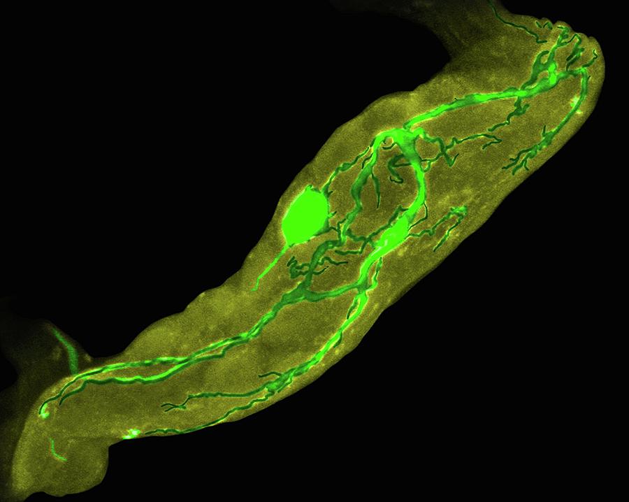 Lobster Stomatogastric Neuron (lobster) by Dennis Kunkel Microscopy ...