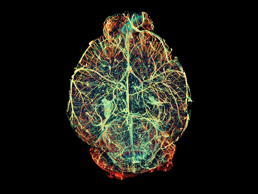 Mouse Brain Blood Vessels by 