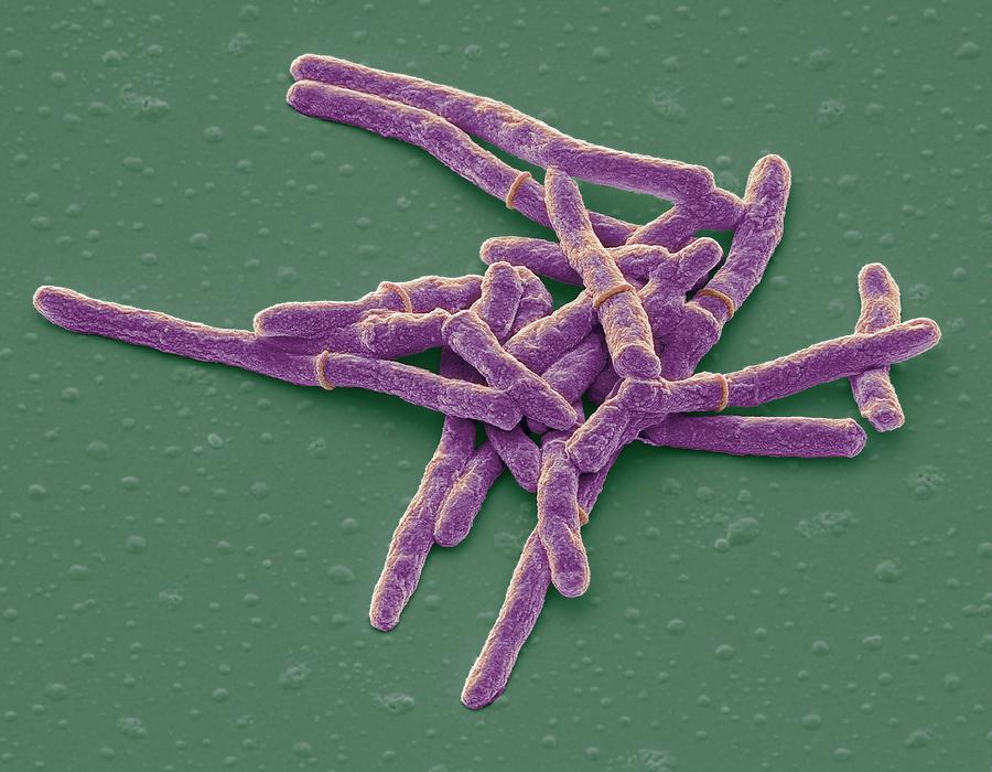 glutathione myscobacterium smegmatis Mycobacterium Smegmatis Bacteria by Steve Gschmeissner / Science Photo  Library