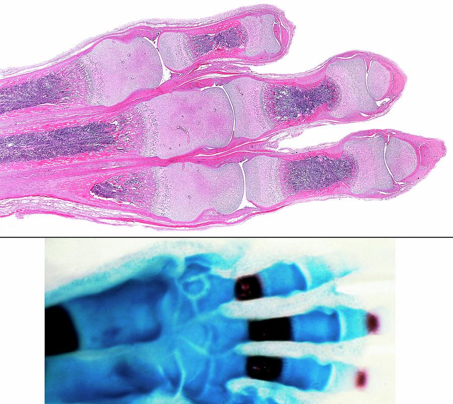 Ossification Of Hand Bones by Jose Calvo / Science Photo Library