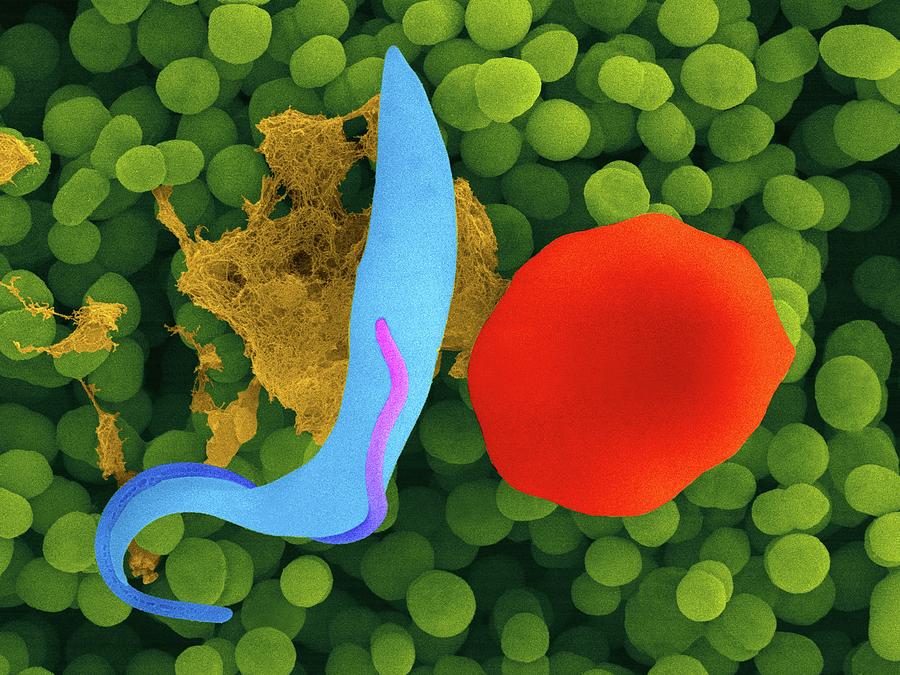 Prokaryote And Eukaryote Cells by Dennis Kunkel Microscopy / Science ...