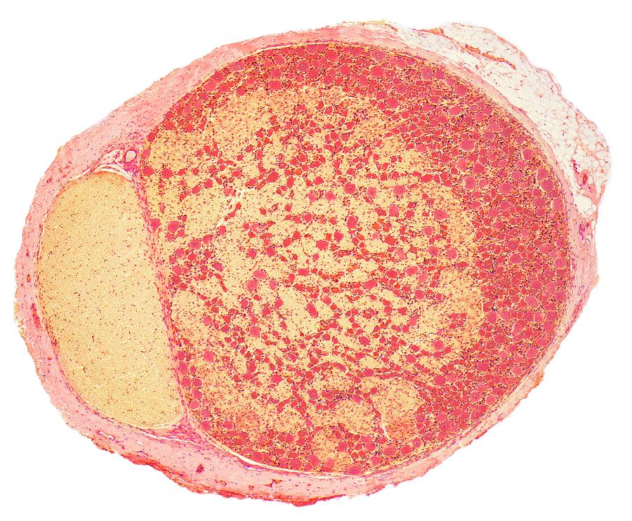 Spinal Nerve Ganglion by Steve Gschmeissner / Science Photo Library