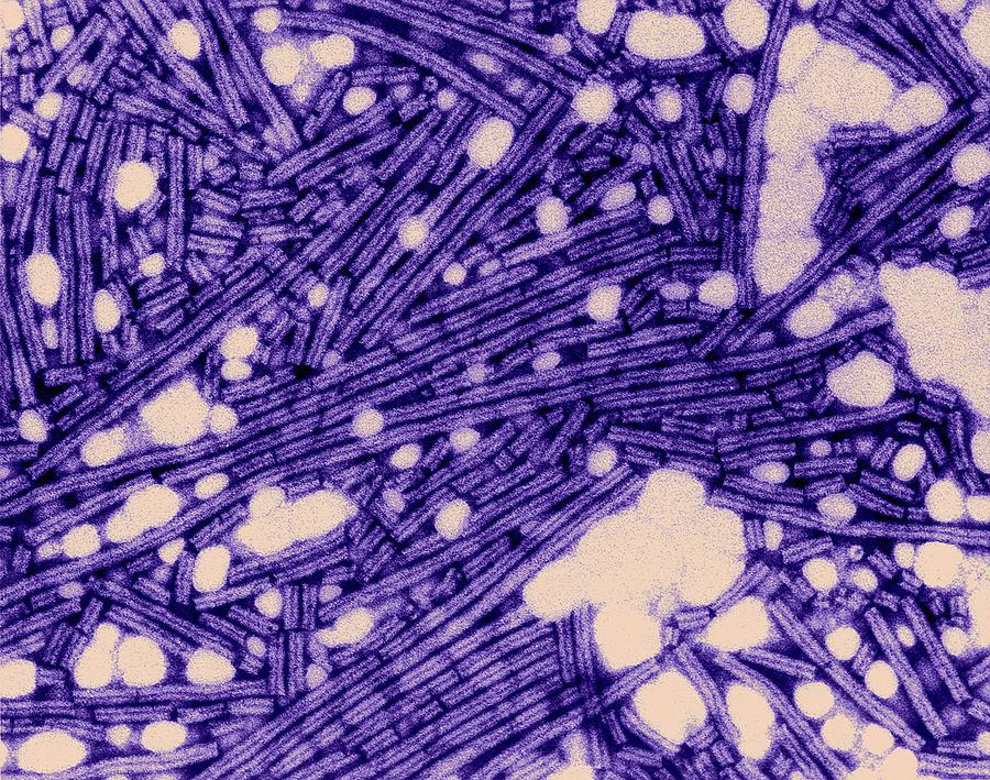 Tobacco Mosaic Virus by Dennis Kunkel Microscopy / Science Photo Library