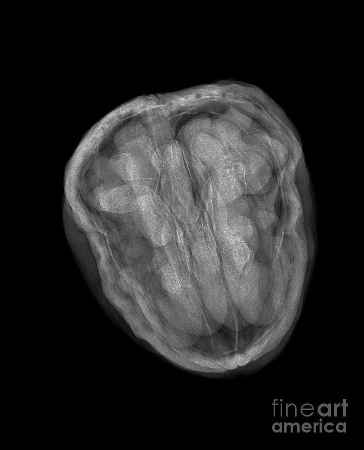 Walnut On Radiograph Walnut X-ray by Bert Myers