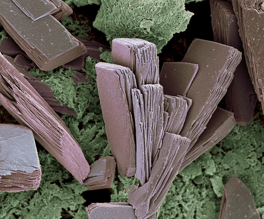 Blood Clot Crystals, Sem #2 by Steve Gschmeissner / Science Photo Library