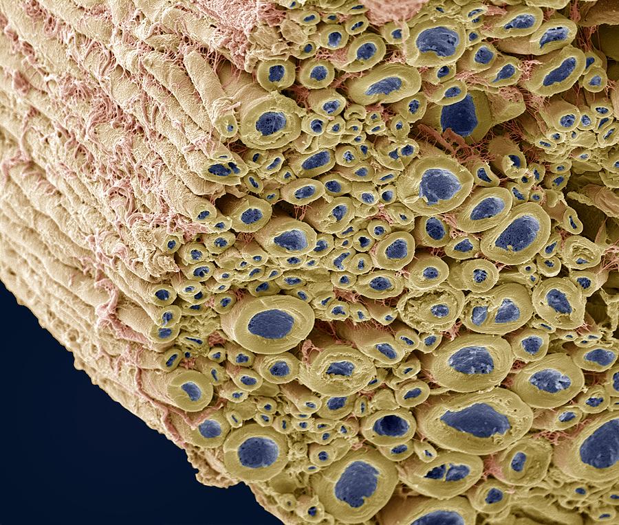 Nerve Bundle, Sem #2 by Steve Gschmeissner / Science Photo Library