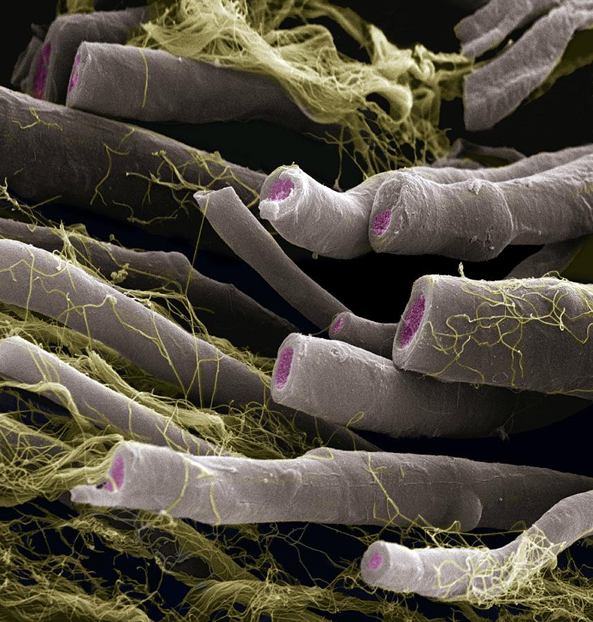 Nerve Fibres, Sem #2 by Steve Gschmeissner / Science Photo Library