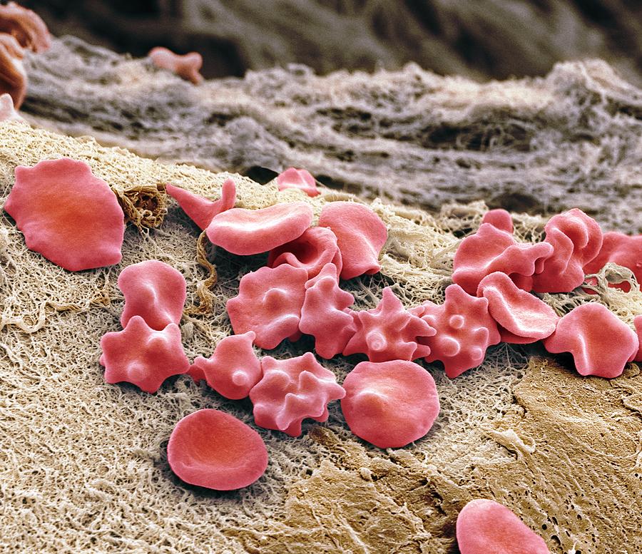 Red Blood Cells, Sem #2 by Steve Gschmeissner / Science Photo Library
