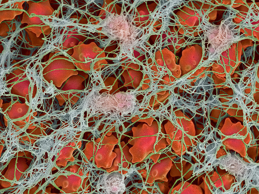 Blood Clot, Sem #27 by Steve Gschmeissner / Science Photo Library
