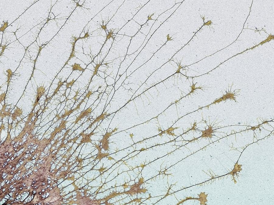 Nerve Cell Culture, Sem #3 by Steve Gschmeissner / Science Photo Library