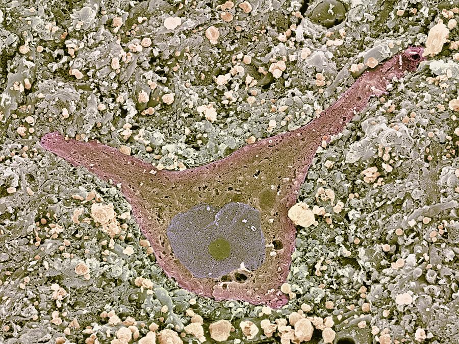 Nerve Cell, Sem #4 by Steve Gschmeissner / Science Photo Library