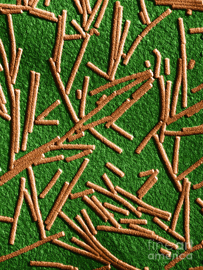 Tobacco Mosaic Virus, Tem #6 by Omikron