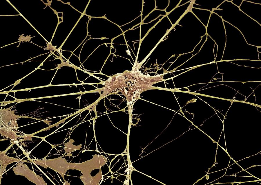 Nerve Cell, Sem #7 by Steve Gschmeissner / Science Photo Library